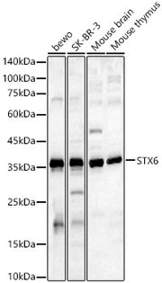 STX6 Rabbit pAb