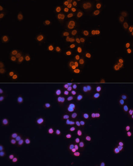 [KD Validated] CDX2 Rabbit pAb