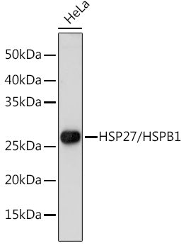 [KO Validated] HSP27/HSPB1 Rabbit pAb