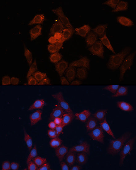 [KO Validated] HSP27/HSPB1 Rabbit pAb