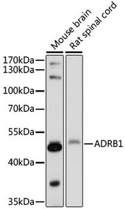 ADRB1 Rabbit pAb