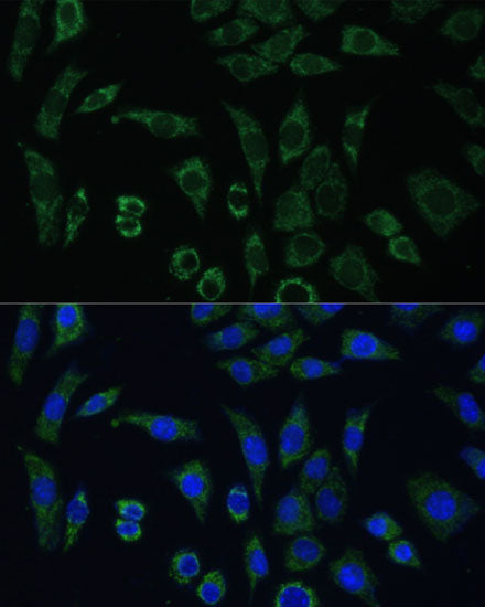 AEBP1 Rabbit pAb