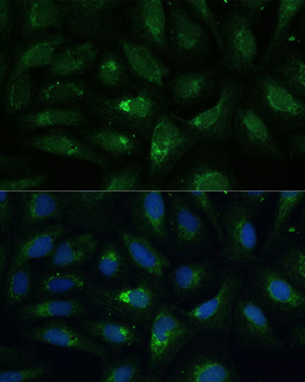 AEBP1 Rabbit pAb