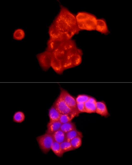 ATP6V0C Rabbit pAb