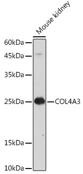 COL4A3 Rabbit pAb