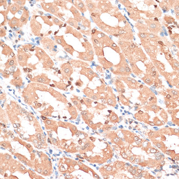 HMGA1 Rabbit pAb