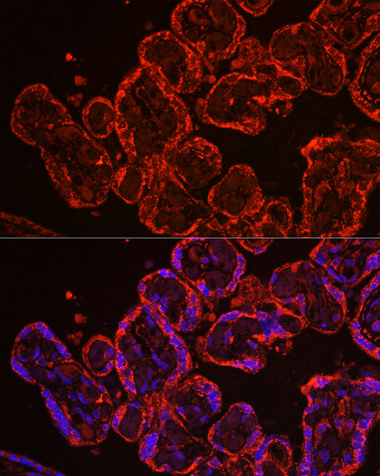 CYP11A1 Rabbit pAb