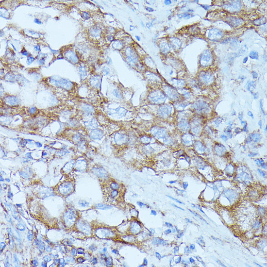 FGD1 Rabbit pAb