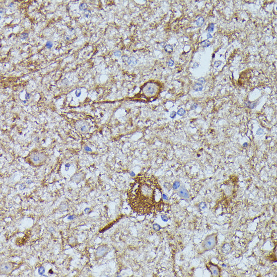 FKBP1B Rabbit pAb