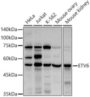 ETV6 Rabbit pAb