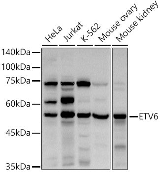 ETV6 Rabbit pAb