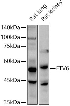 ETV6 Rabbit pAb