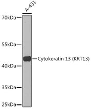 Cytokeratin 13 (KRT13) Rabbit pAb