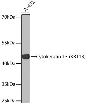 Cytokeratin 13 (KRT13) Rabbit pAb