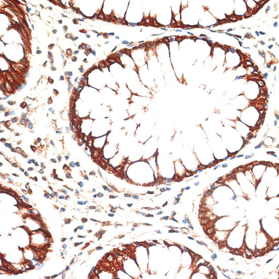 Cytokeratin 13 (KRT13) Rabbit pAb