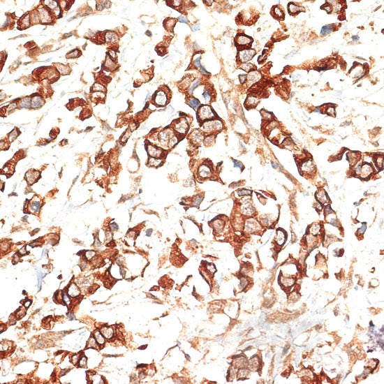 Cytokeratin 13 (KRT13) Rabbit pAb
