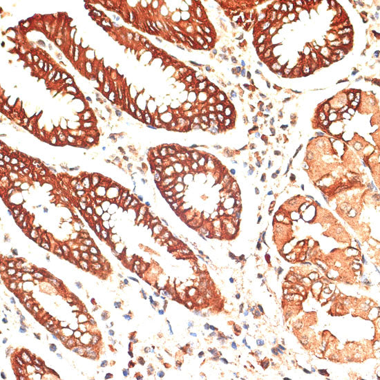 Cytokeratin 13 (KRT13) Rabbit pAb
