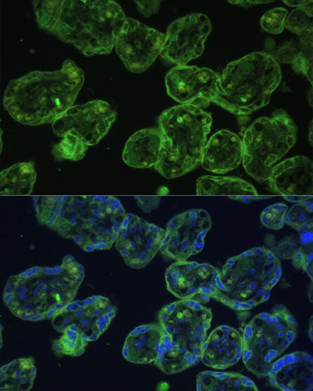 Cytokeratin 13 (KRT13) Rabbit pAb