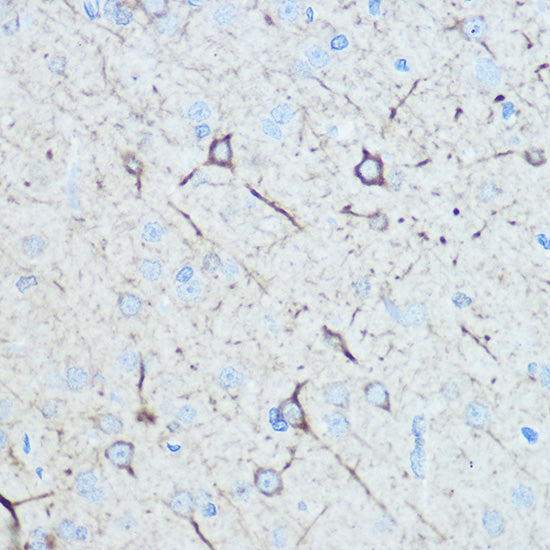 Neurofilament M Rabbit pAb