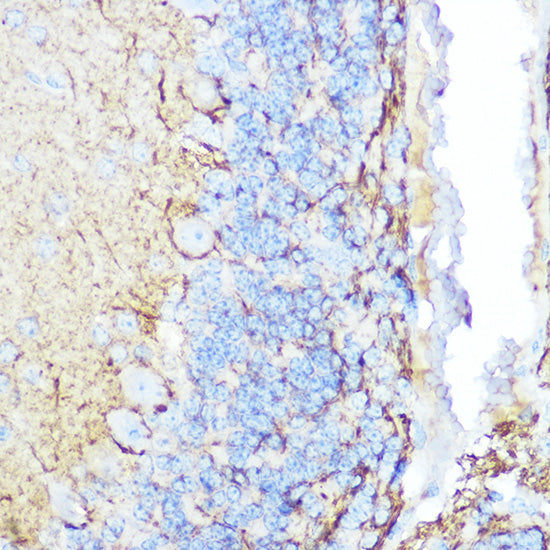 Neurofilament M Rabbit pAb