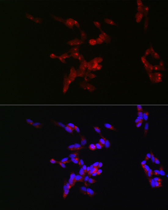 Neurofilament M Rabbit pAb