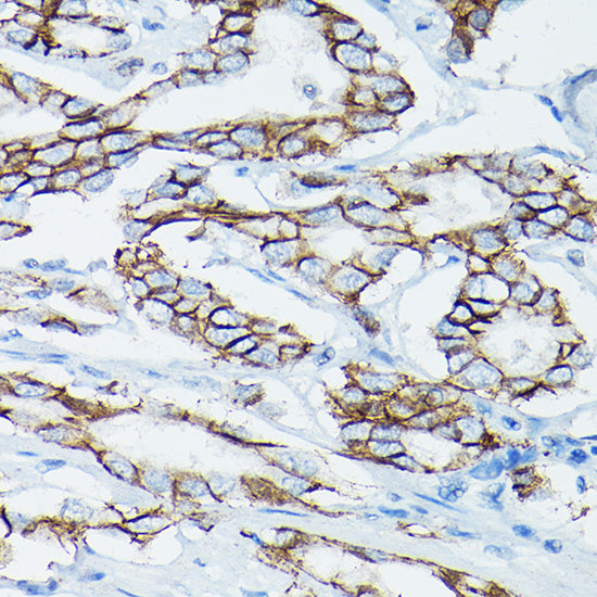 δ-Catenin/p120 Catenin Rabbit pAb