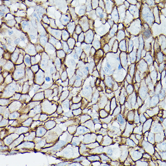 δ-Catenin/p120 Catenin Rabbit pAb