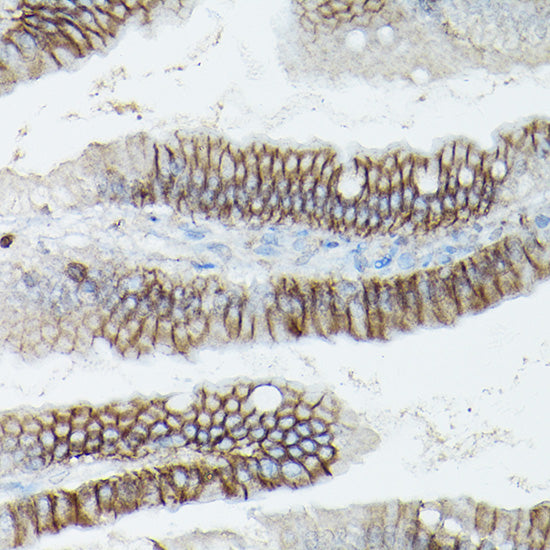 δ-Catenin/p120 Catenin Rabbit pAb