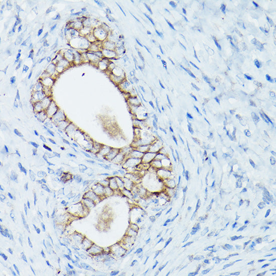δ-Catenin/p120 Catenin Rabbit pAb
