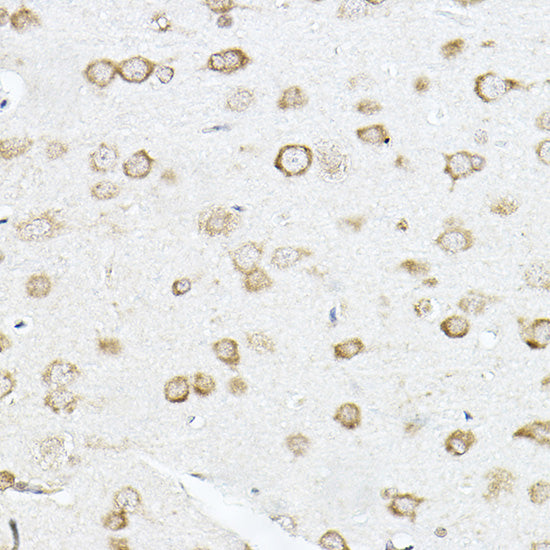 SCD1 Rabbit pAb