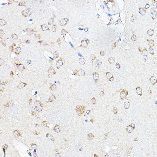 SCD1 Rabbit pAb