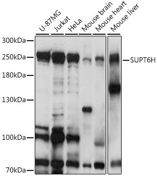 SUPT6H Rabbit pAb