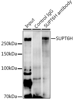 SUPT6H Rabbit pAb