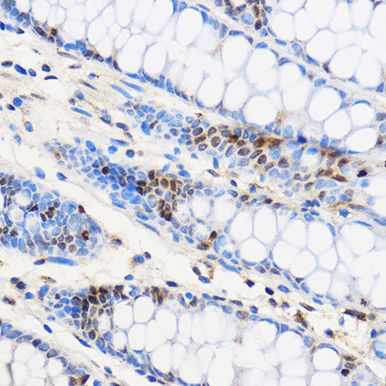 ZNF263 Rabbit pAb
