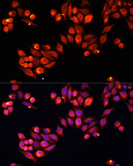 Heparanase 1 Rabbit pAb