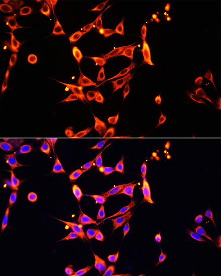 Heparanase 1 Rabbit pAb