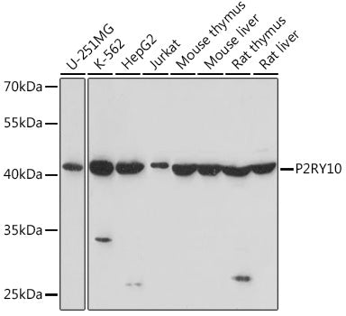 P2RY10 Rabbit pAb