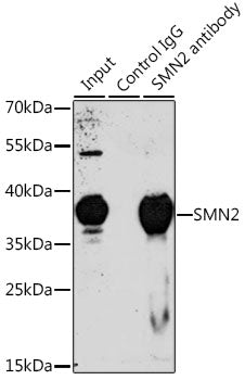 SMN2 Rabbit pAb