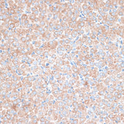 PMEPA1 Rabbit pAb