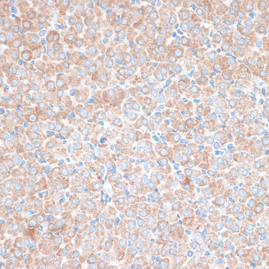 PMEPA1 Rabbit pAb