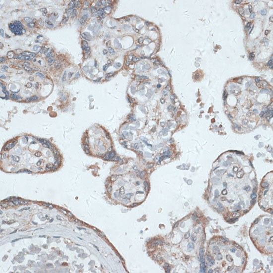 PMEPA1 Rabbit pAb