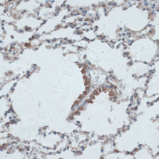 PMEPA1 Rabbit pAb