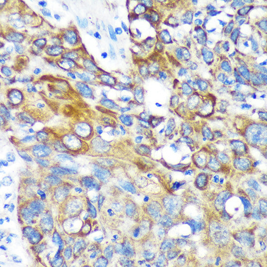 KIF17 Rabbit pAb