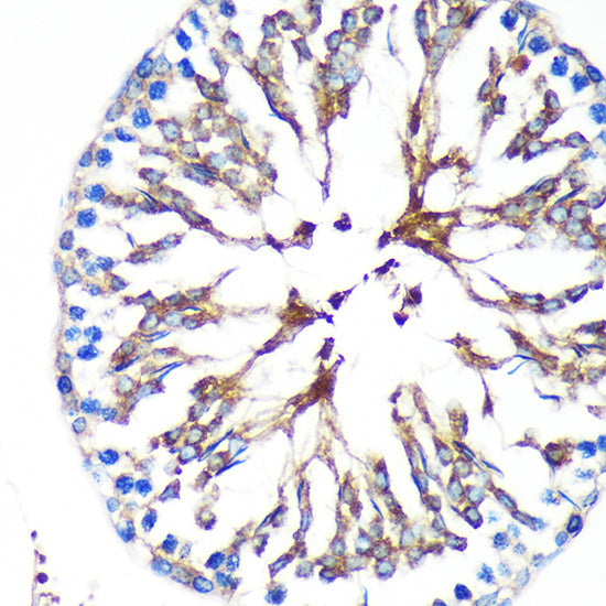 KIF17 Rabbit pAb
