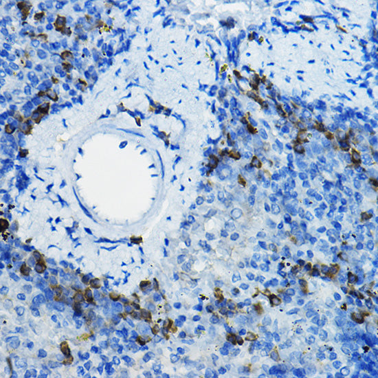 β-TrCP/BTRC Rabbit pAb