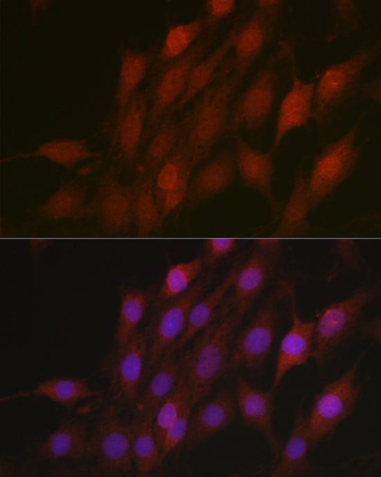β-TrCP/BTRC Rabbit pAb