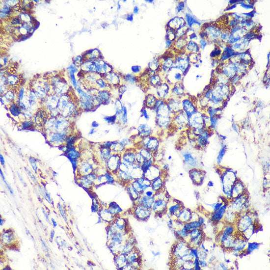 STARD3NL Rabbit pAb