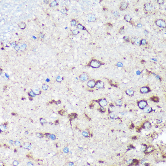 STARD3NL Rabbit pAb