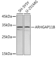 ARHGAP11B Rabbit pAb