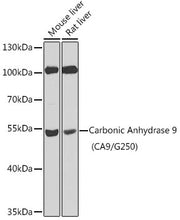 Carbonic Anhydrase 9 (CA9/G250) Rabbit pAb